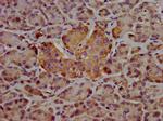 Hepsin Antibody in Immunohistochemistry (Paraffin) (IHC (P))