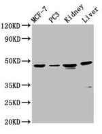 Hepsin Antibody in Western Blot (WB)