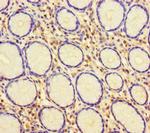 HUS1 Antibody in Immunohistochemistry (Paraffin) (IHC (P))