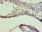 IDH1 Polyclonal Antibody