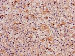 IDH3A Antibody in Immunohistochemistry (Paraffin) (IHC (P))