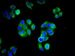 IFITM2 Antibody in Immunocytochemistry (ICC/IF)