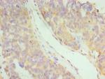 IFNAR2 Polyclonal Antibody