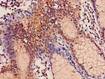 SRM Antibody in Immunohistochemistry (Paraffin) (IHC (P))