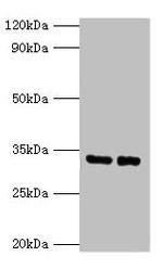 SRM Antibody in Western Blot (WB)