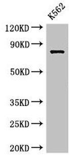IL12RB1 Polyclonal Antibody