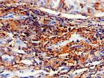 IMPDH2 Antibody in Immunohistochemistry (Paraffin) (IHC (P))
