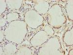 INHBC Polyclonal Antibody