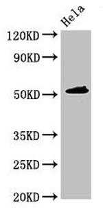 IP6K1 Polyclonal Antibody