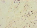 ITGB8 Polyclonal Antibody