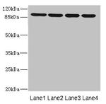 ITGB8 Antibody in Western Blot (WB)
