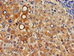 ITM2A Antibody in Immunohistochemistry (Paraffin) (IHC (P))