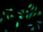 KLHL2 Polyclonal Antibody