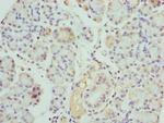 Kallikrein 10 Polyclonal Antibody