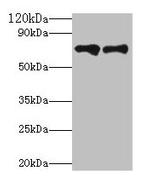 Plasma Kallikrein Polyclonal Antibody