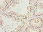KPNA6 Antibody in Immunohistochemistry (Paraffin) (IHC (P))