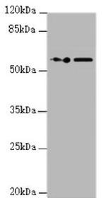 KPNA6 Antibody in Western Blot (WB)