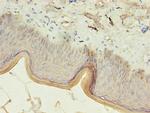 Cytokeratin 10 Antibody in Immunohistochemistry (Paraffin) (IHC (P))