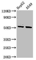 Cytokeratin 16 Antibody in Western Blot (WB)