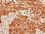 Cytokeratin 6A Polyclonal Antibody
