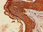 Cytokeratin 6A Antibody in Immunohistochemistry (Paraffin) (IHC (P))