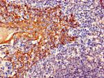 Cytokeratin 6A Antibody in Immunohistochemistry (Paraffin) (IHC (P))