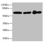 Cytokeratin 6A Antibody in Western Blot (WB)
