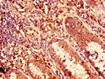 KRT81 Antibody in Immunohistochemistry (Paraffin) (IHC (P))