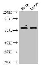 KRT81 Antibody in Western Blot (WB)