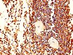 L-Plastin Polyclonal Antibody