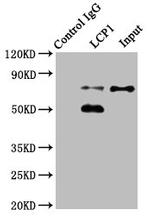L-Plastin Antibody in Western Blot (WB)