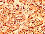 LETM1 Antibody in Immunohistochemistry (Paraffin) (IHC (P))