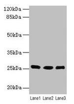 LIN7A Polyclonal Antibody