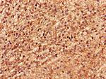 LSM4 Antibody in Immunohistochemistry (Paraffin) (IHC (P))