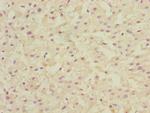 LSS Polyclonal Antibody