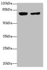 LSS Antibody in Western Blot (WB)