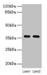 LYPD3 Polyclonal Antibody