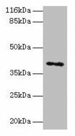 MAGEA10 Antibody in Western Blot (WB)