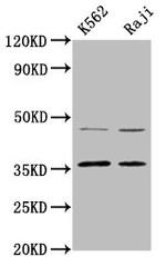 MAGEA2 Polyclonal Antibody