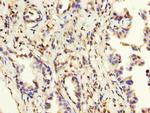 MAGEA3 Polyclonal Antibody