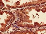 PSMA7 Antibody in Immunohistochemistry (Paraffin) (IHC (P))