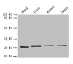 PSMA7 Antibody in Western Blot (WB)
