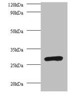 PSMA7 Antibody in Western Blot (WB)