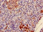 MAOA Antibody in Immunohistochemistry (Paraffin) (IHC (P))