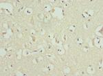 MATK Antibody in Immunohistochemistry (Paraffin) (IHC (P))