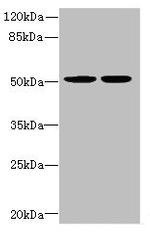 MATK Antibody in Western Blot (WB)
