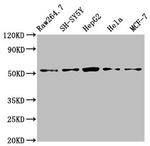 MATN3 Polyclonal Antibody
