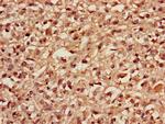 MBD3 Polyclonal Antibody