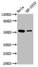 RKHD4 Antibody in Western Blot (WB)
