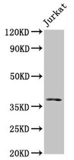 MOS Antibody in Western Blot (WB)
